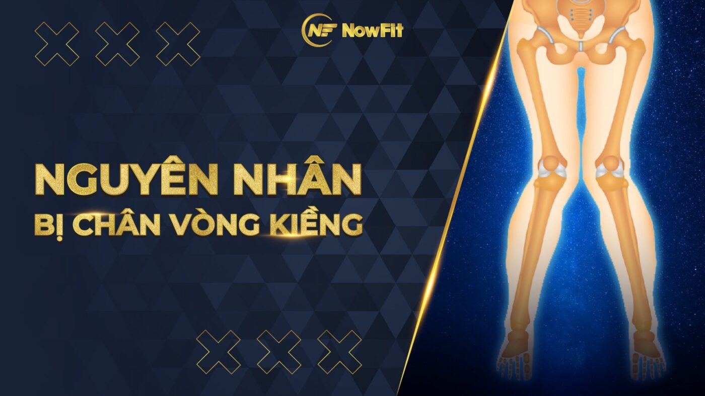 Nguyên nhân bị chân vòng kiềng